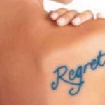 Tattoo Removal Services