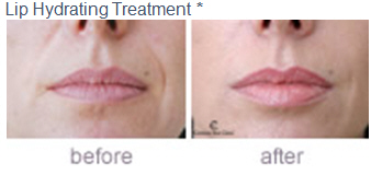 lip-hydrating-before-after