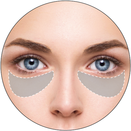 3D hifu Treatments for bags under eyes