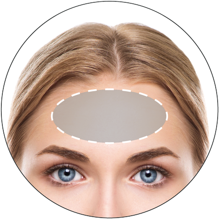 3D HIFU Face Treatments Lines Wrinkles