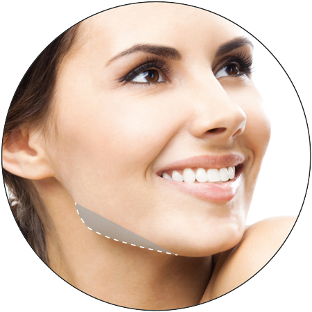3D HIFU Face Treatments on Chin