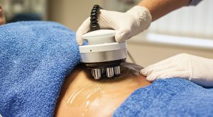 skin-tightening